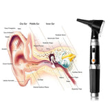 Magnification Diagnostic Ear Scope