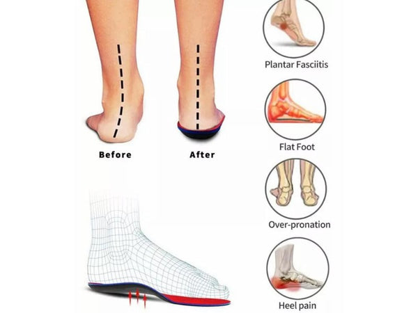 Orthotic Insoles for Plantar Fasciitis & Flat Feet | EU 35-40