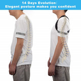 Posture Corrector Back Support