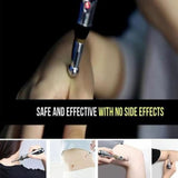 Acupuncture Pen